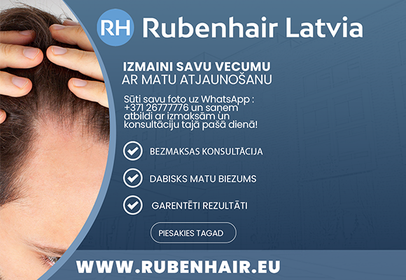 Atgūsti jaunību ar matu transplantāciju Rubenhair ISHRS matu transplantācijas klīnikā